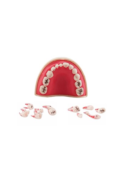mallofdent 12 Dişli Fantom (Pedo) Endodontik Yarım Çene (Kronlu Çürüklü) - Di...