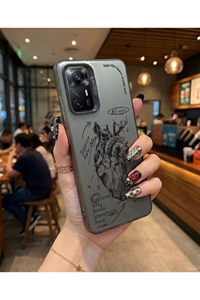 Caseji Redmi Note 12 Pro 5G Uyumlu Anatomik Kalp Baskı Desen Darbe Emici Tele...