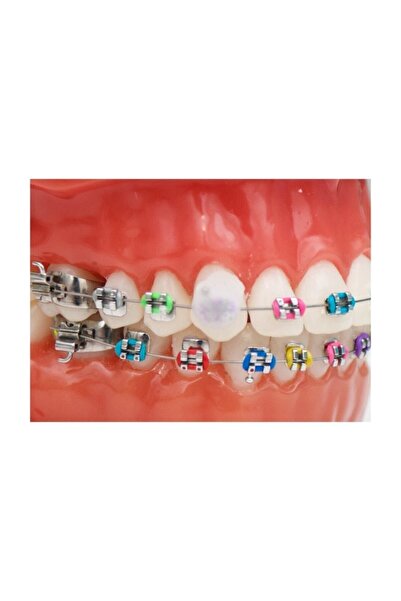Genel Markalar Ortodonti Mumu - Ortho Wax - Diş Teli Mumu - Çilek Aromalı