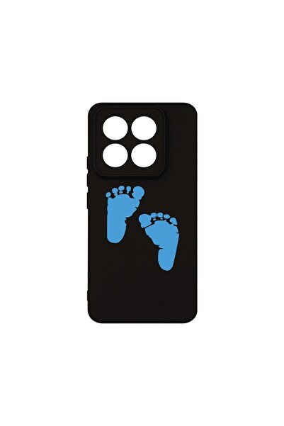 bestcase Θήκη Σιλικόνης Premium, Συμβατή με Xiaomi 14 Pro, Σχέδιο Ποδιών Αγορ...