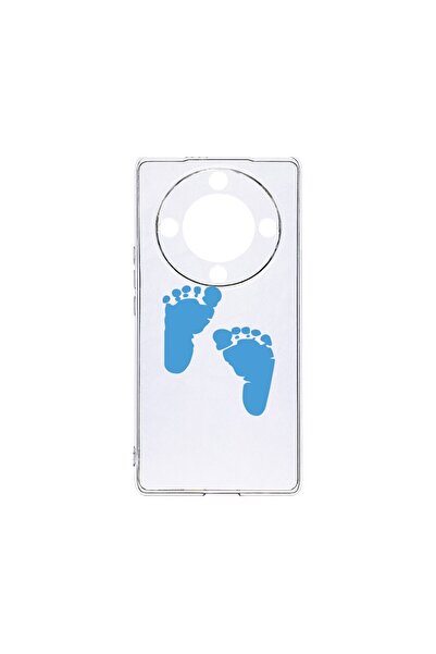bestcase Διαφανής θήκη σιλικόνης 2 χιλιοστών, Συμβατή με Honor Magic6 Lite / ...