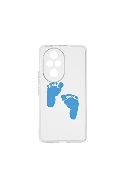 bestcase ¬Æ Husa Clear Silicon 2MM, Compatibila Cu Honor 200, Boy Feet Print,...