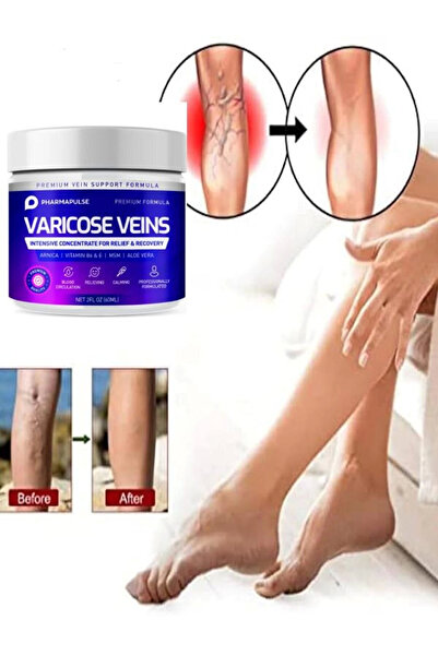 Genel Markalar Maximum Strength Varicose Vein Var.is Bacak Bakım Masaj Kremi ...