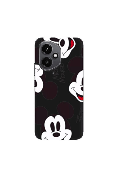 Other Honor Magic 400 Mickey Mouse Black Colored Silicone TPU Θήκη