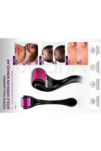 POLATRENDS Titanyum Uçlu 540 Iğneli Derma Roller 0.5 Mm Iğne M 0009 Saç Kaş Serum Kullanımına Uygun
