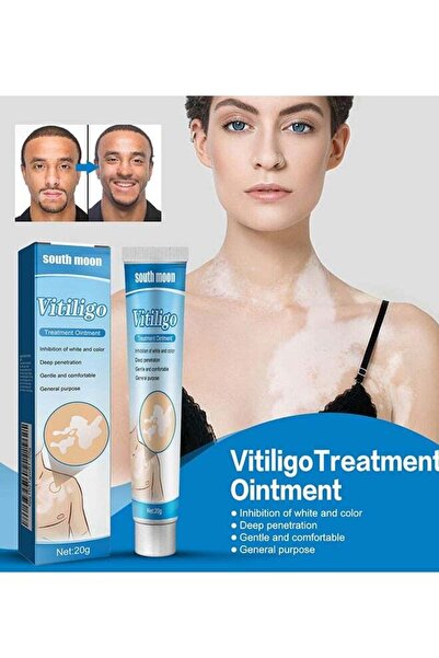 South Moon Vitiligo Treatment Ointment, Vitiligo Care Cream Reduces White Spo...