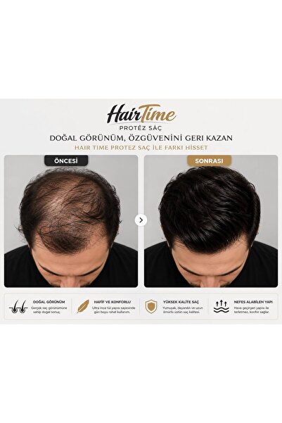 Hairtime 5.8 ÖLÇÜ PROTEZ SAÇ ERKEK GERÇEK İNSAN SAÇI HER YÖNE TARANABİLİR