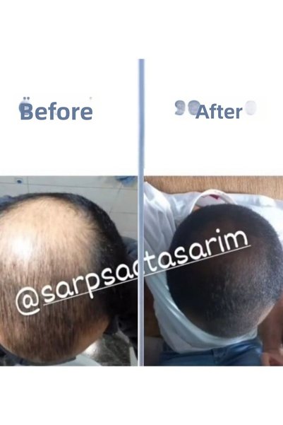 SARPSAC Brawn Hair Care Oil