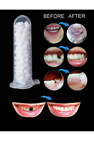 KURBE Pro Thermo Granül 5 Gram Protez Geçici Diş Yapımı, Eksik Diş Giderme, K...