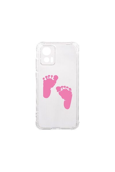 bestcase Husa BestCase¬Æ Anti Shock 1.5MM, Compatibila Cu Motorola Edge 30 Ne...