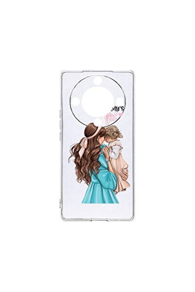 bestcase Θήκη Διαφανής Σιλικόνη 2MM, Συμβατή με Honor Magic6 Lite / X9b / X50...