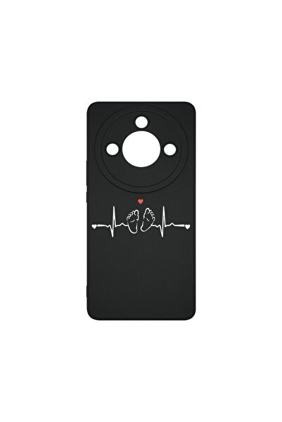 bestcase Husa BestCase¬Æ Slim SIlicon 0.8MM, Compatibila Cu Honor X50, My Lit...