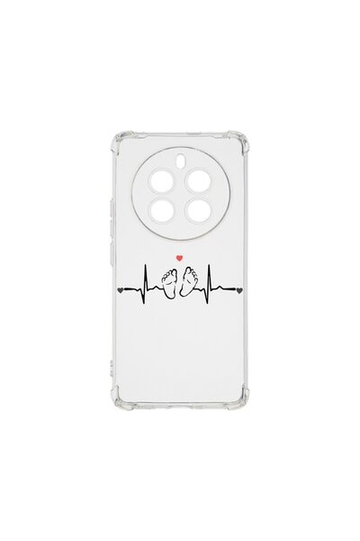 bestcase Αντικραδασμική Θήκη 1.5MM, Συμβατή με Realme 12 Pro, My Little Love,...