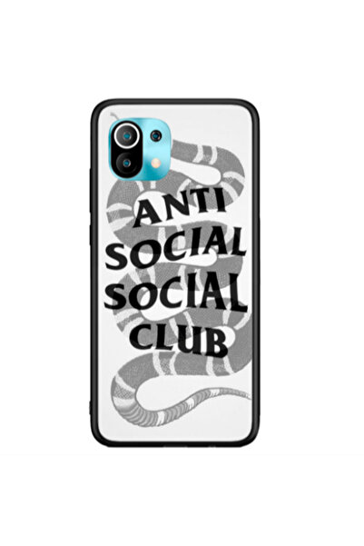 Other Xiaomi Mi 11 Social club Black Glossy Θήκη