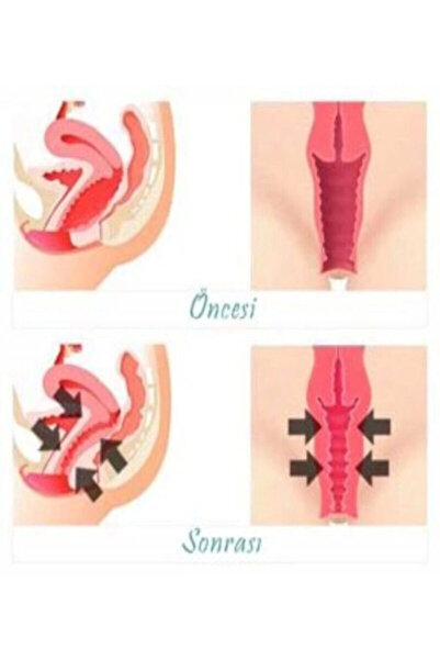 Genel Markalar Vagitight Kadınlar İçin Genital Bölge Şekillendirici Krem 100 ...