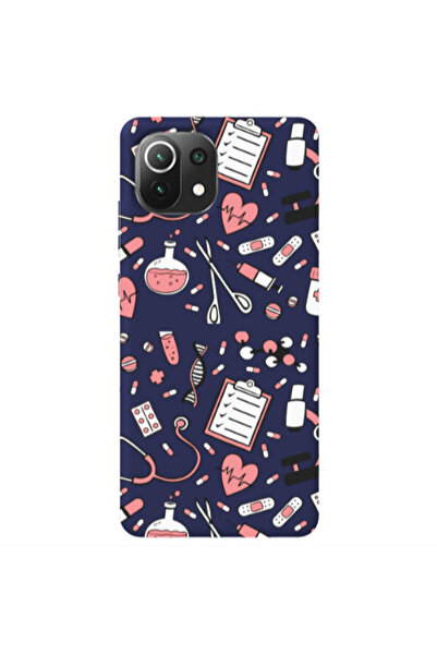 Other Xiaomi Mi 11 Lite Laboratory Dark blue Colored Silicone TPU Θήκη