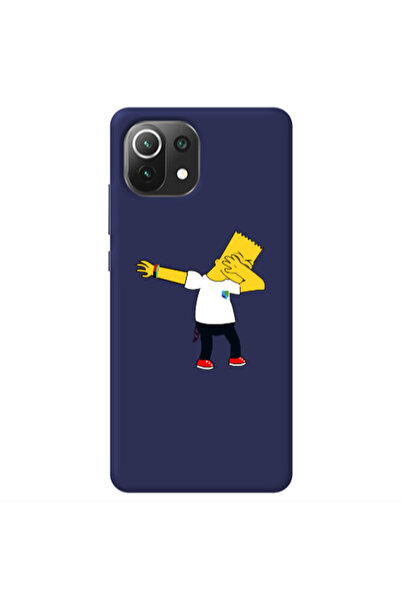 Other Xiaomi Mi 11 Lite Simpsons2 Dark blue Colored Silicone TPU Θήκη