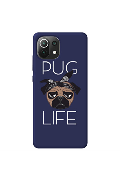 Other Xiaomi Mi 11 Lite Pug Life Dark blue Colored Silicone TPU Θήκη