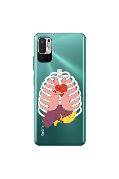 Other Xiaomi Redmi Note 10 Pro 5G Anatomy Transparent Silicone TPU Θήκη