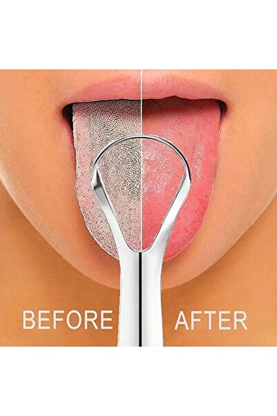 Choice 1Pcs Portable Single Layer Tongue Scraper Reusable Stainless Oral Mout...