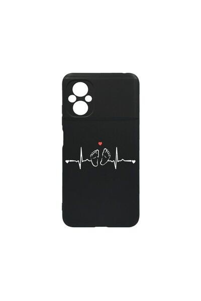 bestcase Husa BestCase¬Æ Slim SIlicon 0.8MM, Compatibila Cu Xiaomi Poco M5, M...