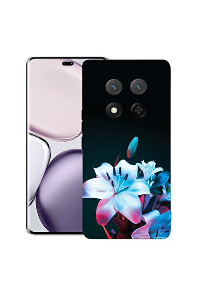 bestcase Калъф за Honor Magic 7 Lite, Премиум тънък силиконов 1.2ММ, Орхидея,...