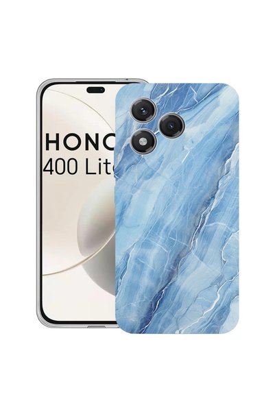 bestcase Калъф за Honor 400 Lite 5G, BestCase™ Прозрачен силиконов 2ММ, Син м...