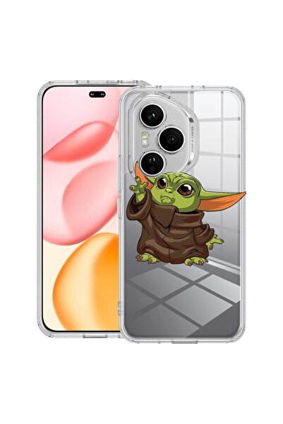 bestcase Διαφανής Θήκη Σιλικόνης για Honor 400 Pro, Baby Yoda, 2036424 T 1635