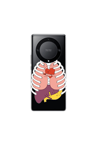 Other Honor Magic5 Lite 5G Anatomy Transparent Silicone TPU Θήκη
