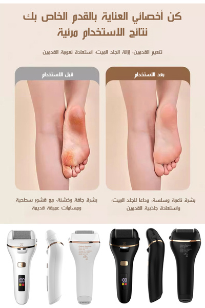 Other مبرد قدم كهربائي مزيل مسامير القدم والجلد الميت مقاوم للماء مع شاشة رقم...
