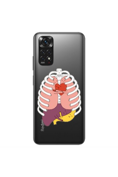 Other Xiaomi Redmi Note 11S NFC Anatomy Transparent Silicone TPU Θήκη