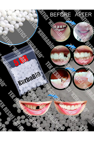 KURBE Pro Thermo Granül 5 Gram Protez Geçici Diş Yapımı, Eksik Diş Giderme, K...