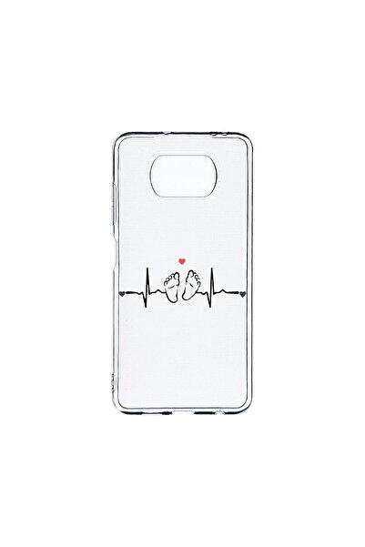 bestcase Прозрачен силиконов калъф 2ММ, съвместим с Xiaomi Poco X3 Pro / Poco...