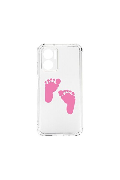 bestcase Husa BestCase¬Æ Anti Shock 1,5mm, Compatibila Cu Xiaomi Redmi 10 5G,...