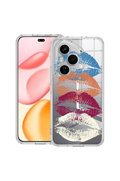 bestcase ¬Æ Husa Clear Silicon pentru Honor 400 Pro, Kiss Kiss, 2036424 T 1807