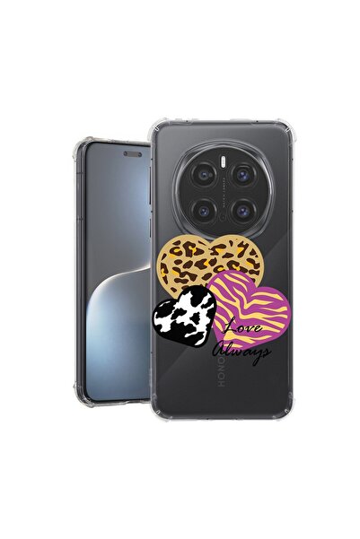 bestcase Αντικραδασμική Θήκη για Honor Magic7 Pro, Love Always, 1926356 AS 1860