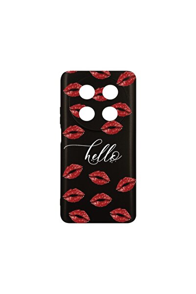 bestcase Λεπτή Θήκη Σιλικόνης 0.8MM, Συμβατή με Huawei Nova 12i, Hello Kisses...