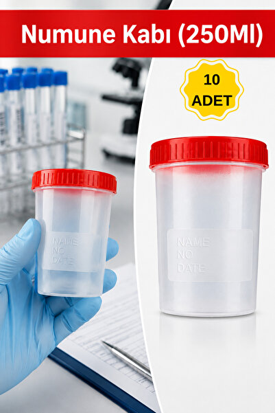 Arkhelais İdrar Kabı - İdrar Numune Kabı - Steril Numune Kabı 100 ml Kapaklı ...