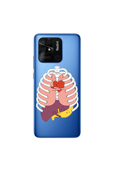 Other Xiaomi Poco C40 Anatomy Transparent Silicone TPU Θήκη