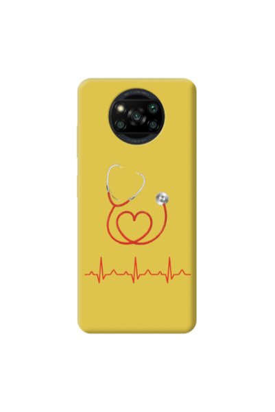 Other Xiaomi Poco X3 /X3 Pro Stethoscope Yellow Colored Silicone TPU Θήκη