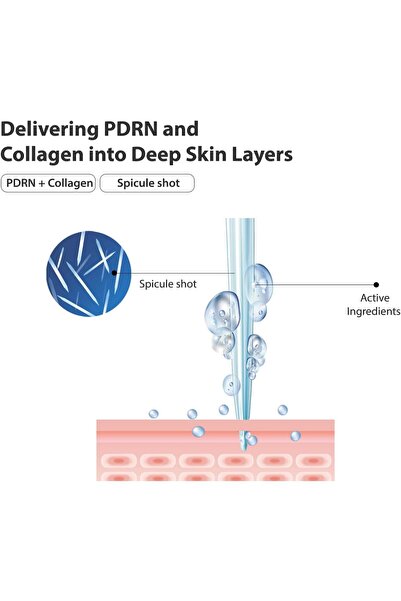 wati for skin Ser PDRN + Biome Microshot 100 cu microneedling, glow, hidratare intensă și fermitate, Korean Bauty