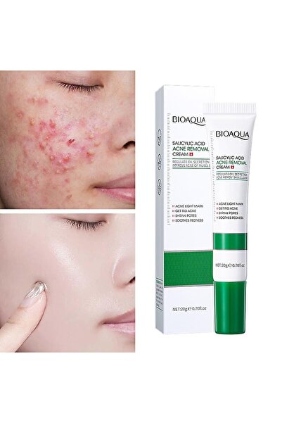 Bioaqua Salicylic Acid Oil Control and Pore Care Cream 20 Gr |   For Oily and...