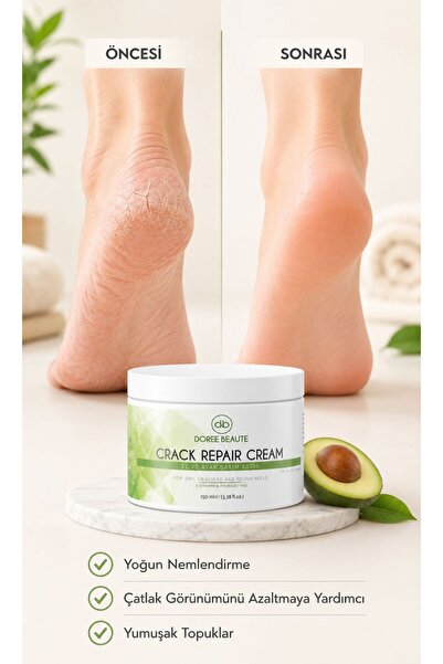 DOREE BEAUTE Ayak Ve Topuk Çatlak Kremi, Ayak Bakımı, Ayak Kokusu Ve Topuk 100ml