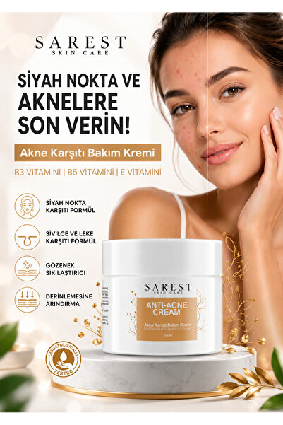 Sarest skincare Anti-Pimple Cream Containing Vitamins, Blackhead Pimple - Ant...