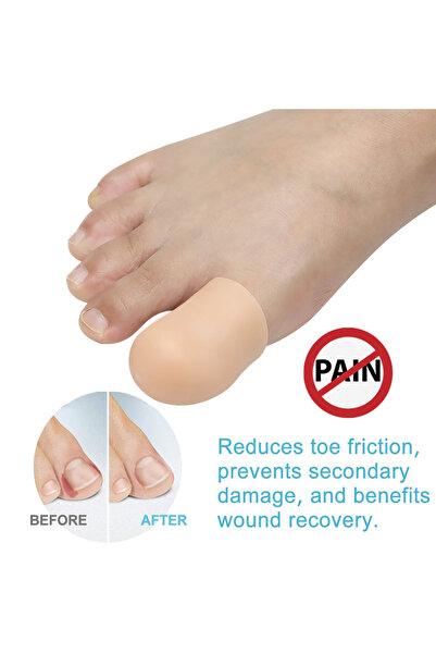 Choice1 Beige-2Pcs Pexmen 2/4Pcs Big Toe Caps Gel Toe Covers Protect Toe from...
