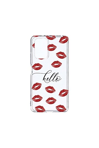 bestcase Прозрачен силиконов калъф 2ММ, съвместим с Xiaomi Redmi Note 10 4G, ...
