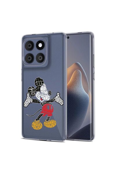 bestcase Θήκη για Motorola Edge 60 Fusion 5G, BestCase™ Διαφανής Σιλικόνη 2MM...