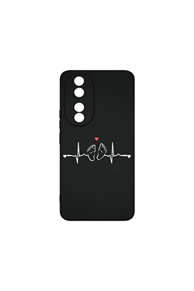 bestcase Husa BestCase® Silicon Lichid Premium, Compatibilă cu Honor 90, My L...