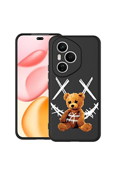 bestcase Ултра тънък силиконов калъф за Honor 400 Pro с дизайн на усмихнато п...