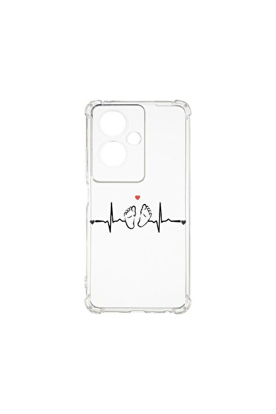 bestcase Husa BestCase¬Æ Anti Shock 1.5MM, Compatibila Cu OPPO A79 5G, My Lit...